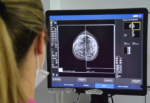 En provincia de Buenos Aires se realizan mamografías gratis en octubre