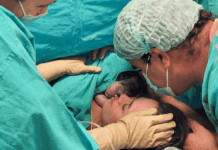 Nació la primera bebé operada dentro del útero en el Hospital Garrahan